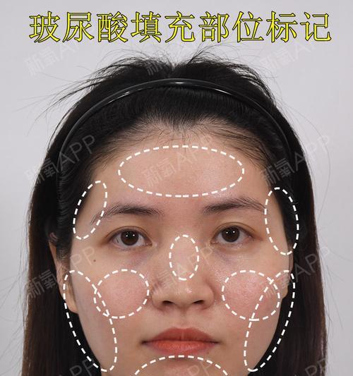 女生莫名失去脸型，该如何找回美丽？（面容失真、身心俱损，解决方法大揭秘！）-第2张图片-恋语空间